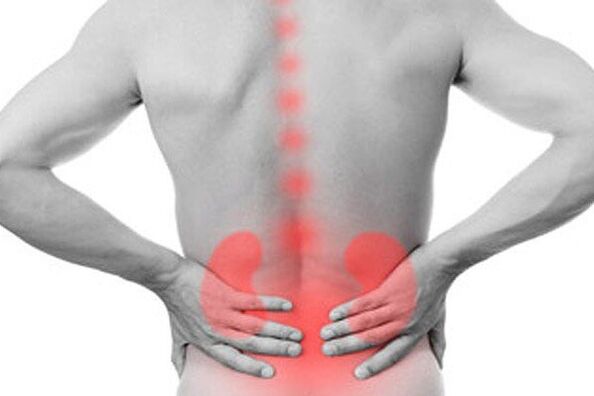 Renal pathologies can cause the onset of low back pain
