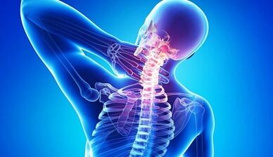 Symptoms and treatment of cervical osteochondrosis