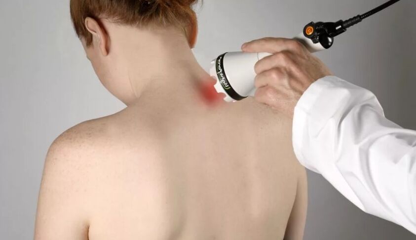 Physiotherapeutic Method to treat cervical osteochondrosis