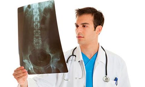 doctor looking at x-ray to diagnose low back pain